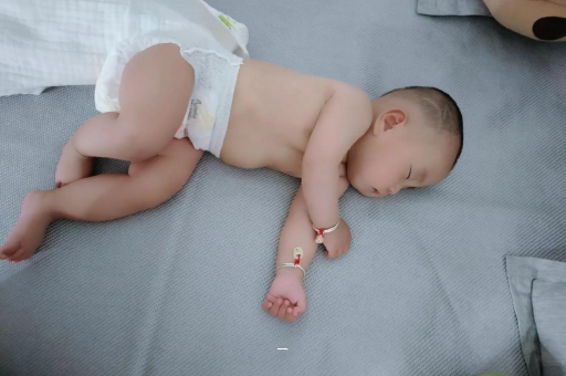 黔南宝宝脸上有白色斑块